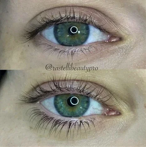 Pestanas Inferiores - 0.10 J