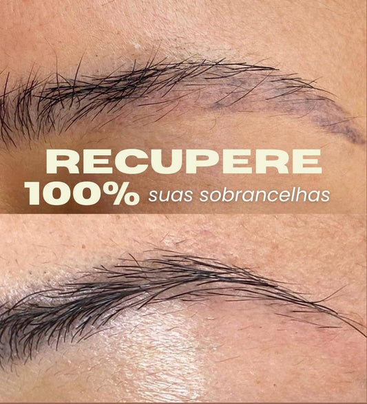 Royal Repair Methode